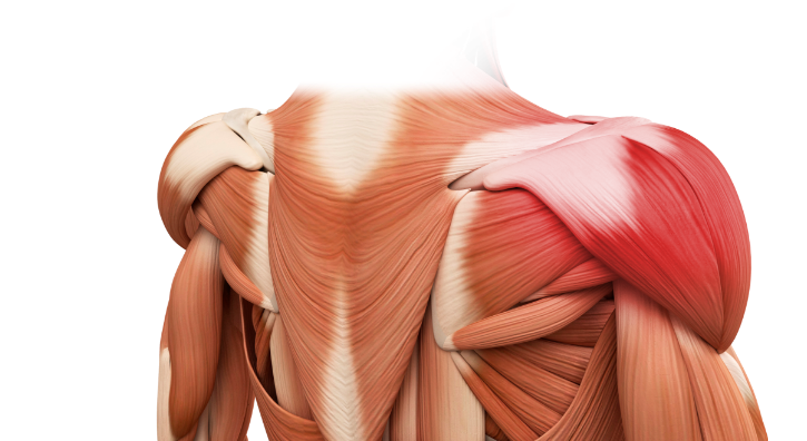 근막통증증후군