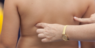 신경 근육성 질환 증상